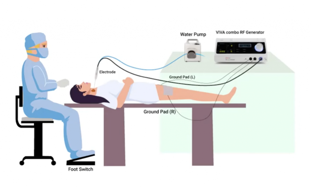 thyroid rfa ablation setup specialist outpatient center